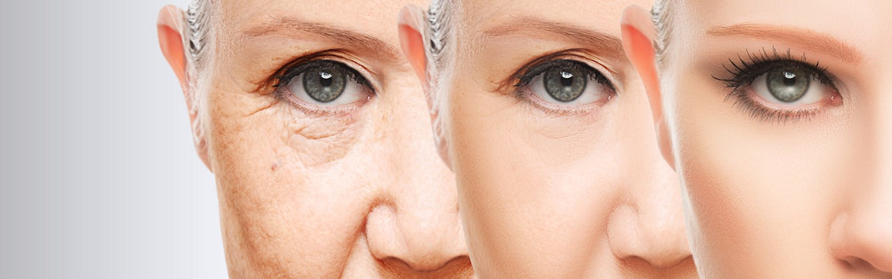 What Are Some Instant Ways to Fix Crow’s Feet and Dark Circles?