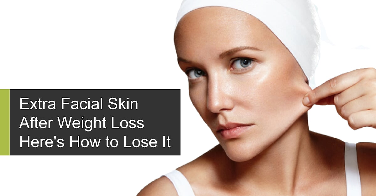 Extra Facial Skin After Weight Loss - Here's How to Lose It