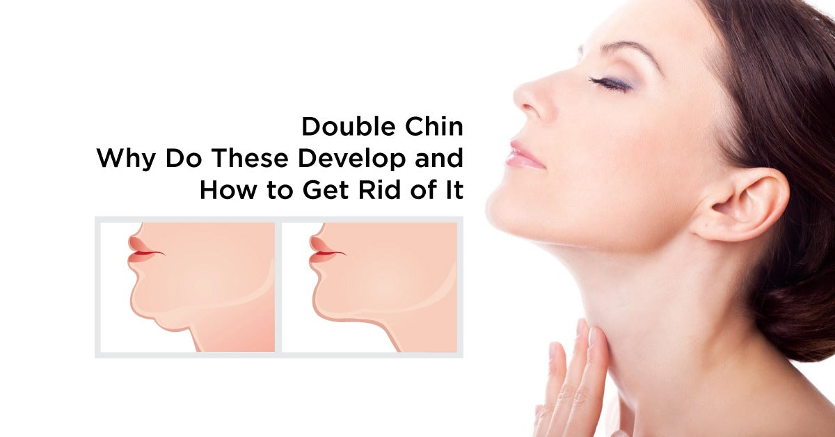 Double Chin - Why Do These Develop and How to Get Rid of It