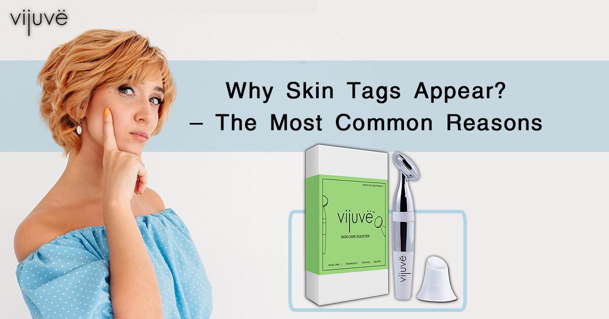 Everything You Got To Know About Skin Tag