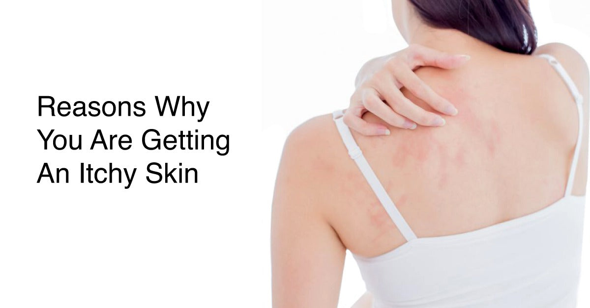 5 Reasons You Can Get Itchy Skin